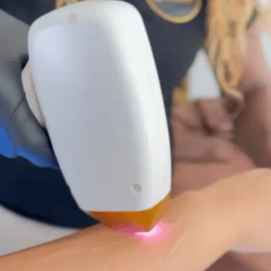 Curso Intensivo Láser de Yodo